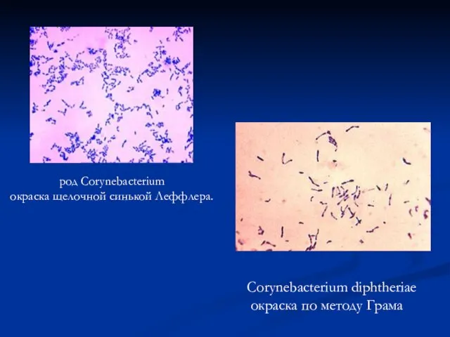 род Corynebacterium окраска щелочной синькой Леффлера. Corynebacterium diphtheriae окраска по методу Грама