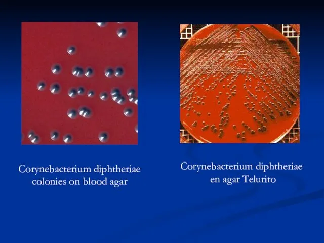 Corynebacterium diphtheriae colonies on blood agar Corynebacterium diphtheriae en agar Telurito