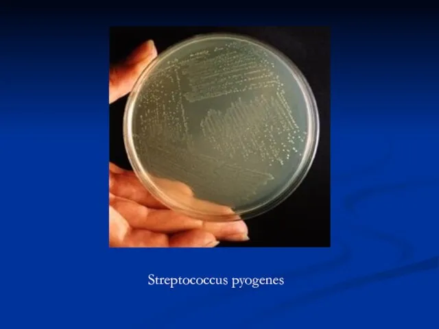 Streptococcus pyogenes