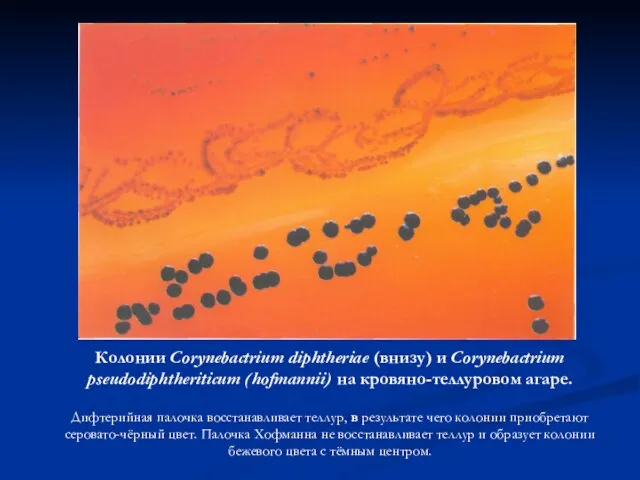 Колонии Corynebactrium diphtheriae (внизу) и Corynebactrium pseudodiphtheriticum (hofmannii) на кровяно-теллуровом агаре.