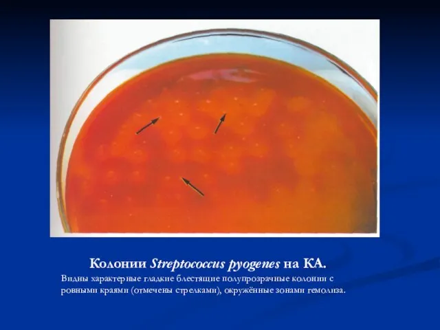 Колонии Streptococcus pyogenes на КА. Видны характерные гладкие блестящие полупрозрачные колонии
