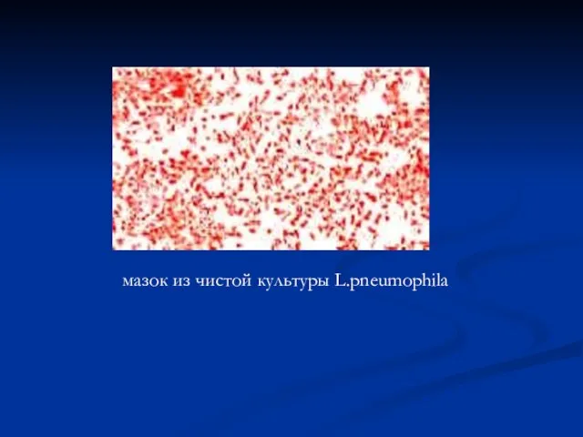 мазок из чистой культуры L.pneumophila