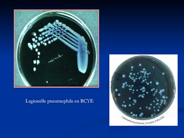 Legionella pneumophila en BCYE