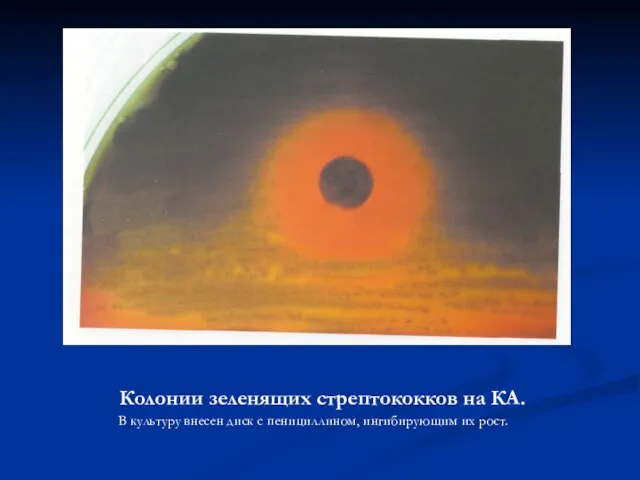 Колонии зеленящих стрептококков на КА. В культуру внесен диск с пенициллином, ингибирующим их рост.