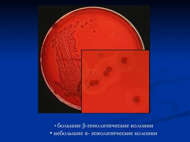 большие β-гемолитические колонии небольшие α- гемолитические колонии