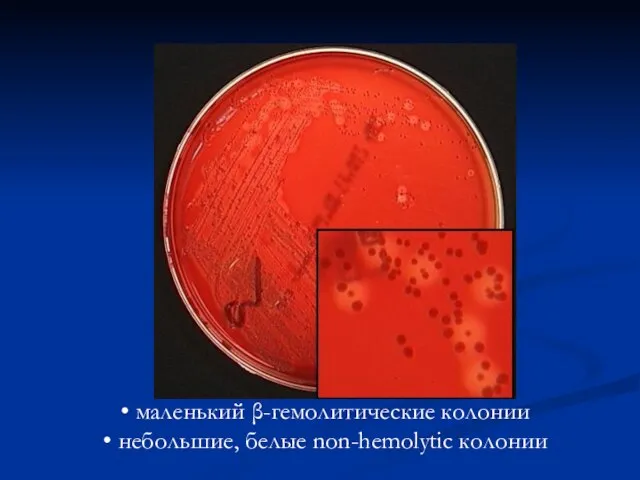 маленький β-гемолитические колонии небольшие, белые non-hemolytic колонии