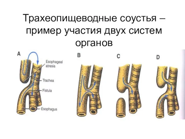 Трахеопищеводные соустья – пример участия двух систем органов