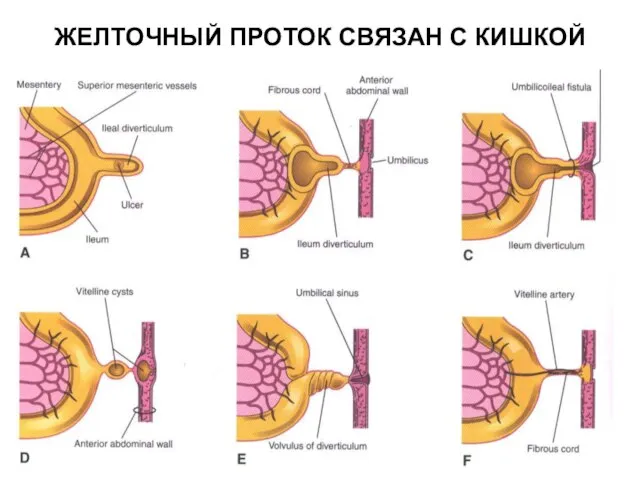 ЖЕЛТОЧНЫЙ ПРОТОК СВЯЗАН С КИШКОЙ