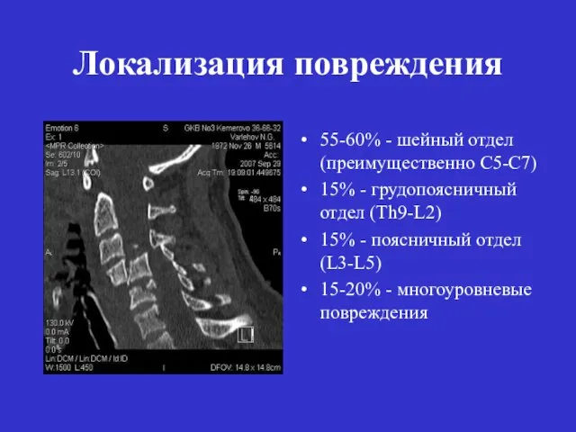 Локализация повреждения 55-60% - шейный отдел (преимущественно С5-С7) 15% - грудопоясничный