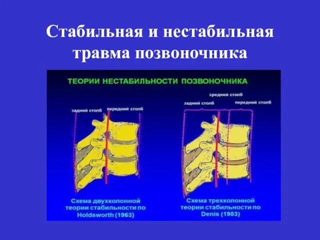 Стабильная и нестабильная травма позвоночника