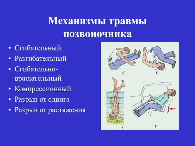 Механизмы травмы позвоночника Сгибательный Разгибательный Сгибательно-вращательный Компрессионный Разрыв от сдвига Разрыв от растяжения