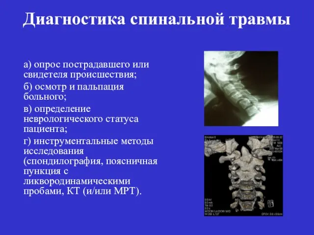 Диагностика спинальной травмы а) опрос пострадавшего или свидетеля происшествия; б) осмотр