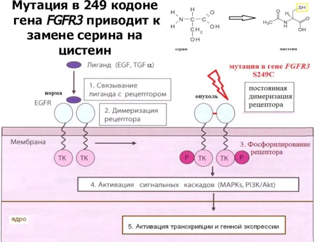 Мутация в 249 кодоне гена FGFR3 приводит к замене серина на цистеин