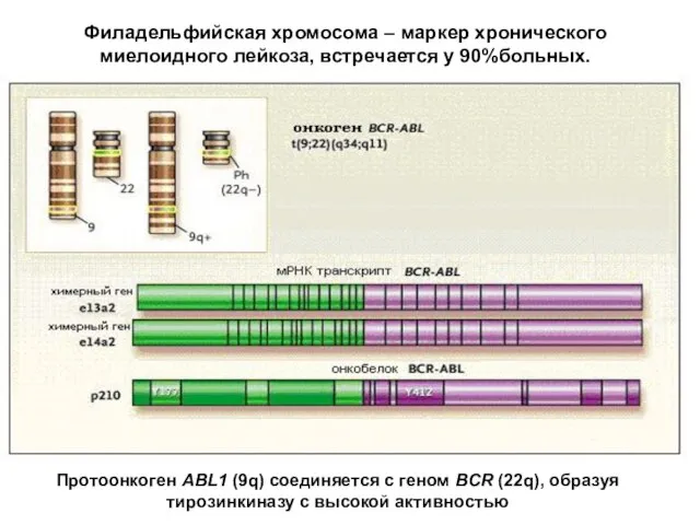 Филадельфийская хромосома – маркер хронического миелоидного лейкоза, встречается у 90%больных. Протоонкоген