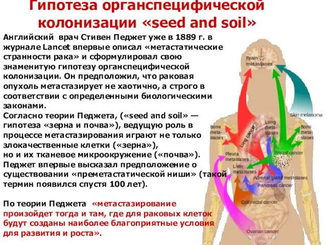 Гипотеза органспецифической колонизации «seed and soil» Английский врач Стивен Педжет уже