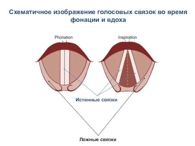 Схематичное изображение голосовых связок во время фонации и вдоха Истинные связки Ложные связки