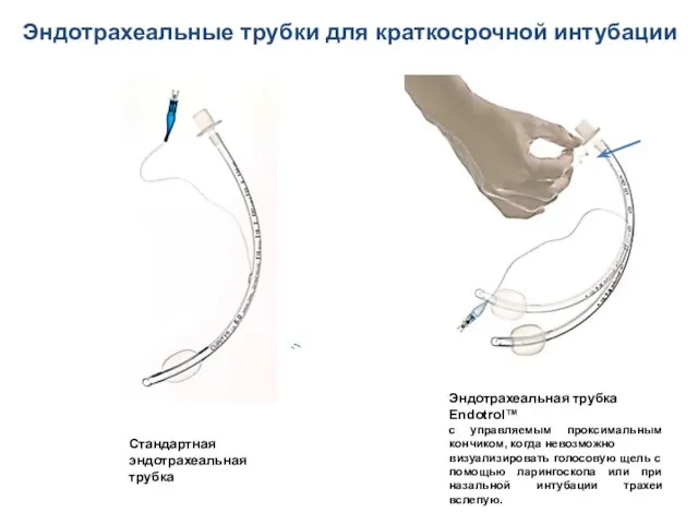 Стандартная эндотрахеальная трубка Эндотрахеальная трубка Endotrol™ с управляемым проксимальным кончиком, когда