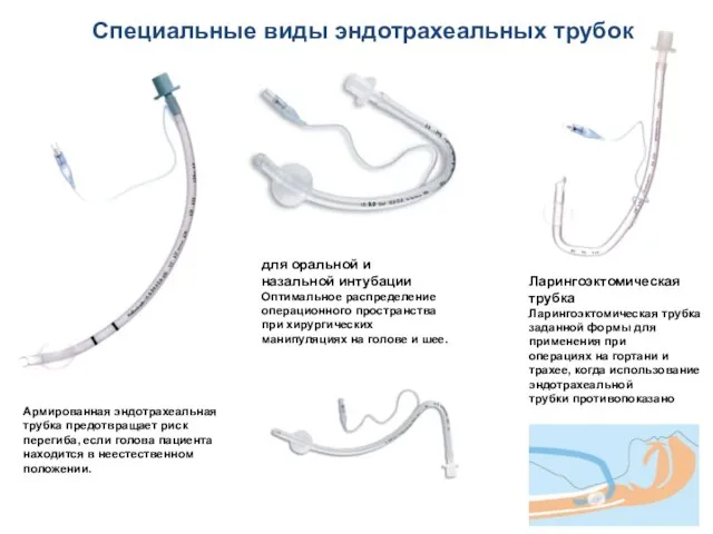 Армированная эндотрахеальная трубка предотвращает риск перегиба, если голова пациента находится в