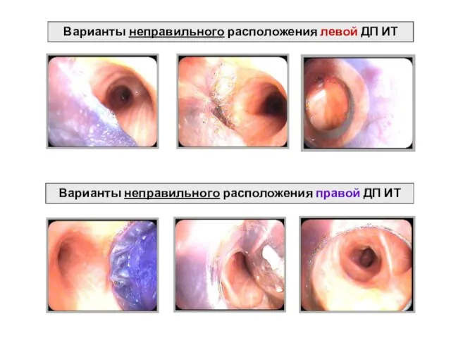 Варианты неправильного расположения левой ДП ИТ Варианты неправильного расположения правой ДП ИТ