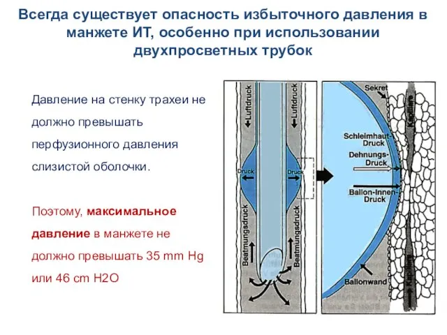 Давление на стенку трахеи не должно превышать перфузионного давления слизистой оболочки.