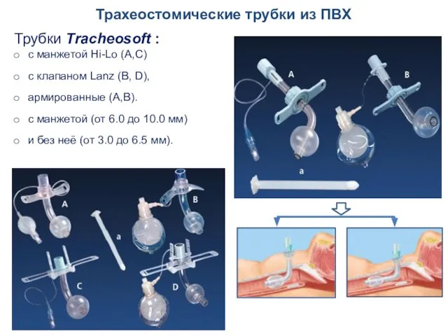 Трахеостомические трубки из ПВХ Трубки Tracheosoft : с манжетой Hi-Lo (A,C)