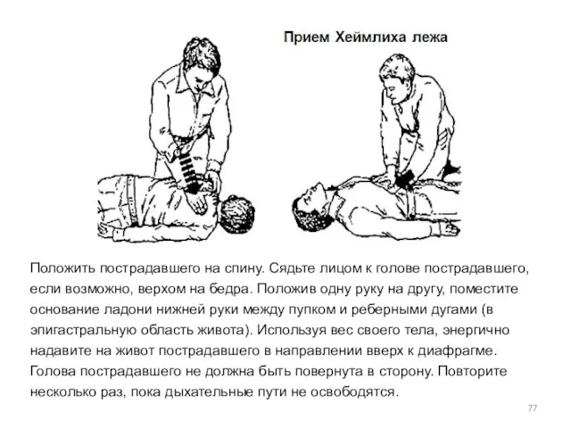 Положить пострадавшего на спину. Сядьте лицом к голове пострадавшего, если возможно,