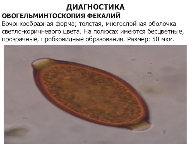 ДИАГНОСТИКА ОВОГЕЛЬМИНТОСКОПИЯ ФЕКАЛИЙ Бочонкообразная форма; толстая, многослойная оболочка светло-коричневого цвета. На