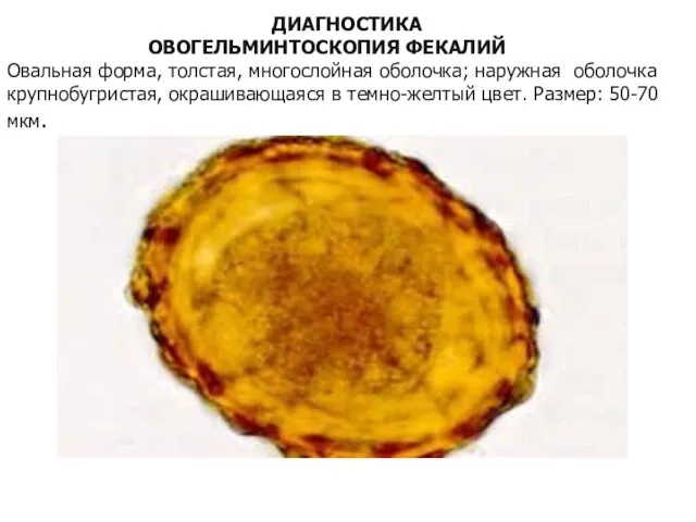 ДИАГНОСТИКА ОВОГЕЛЬМИНТОСКОПИЯ ФЕКАЛИЙ Овальная форма, толстая, многослойная обо­лочка; наружная оболочка крупнобугристая,