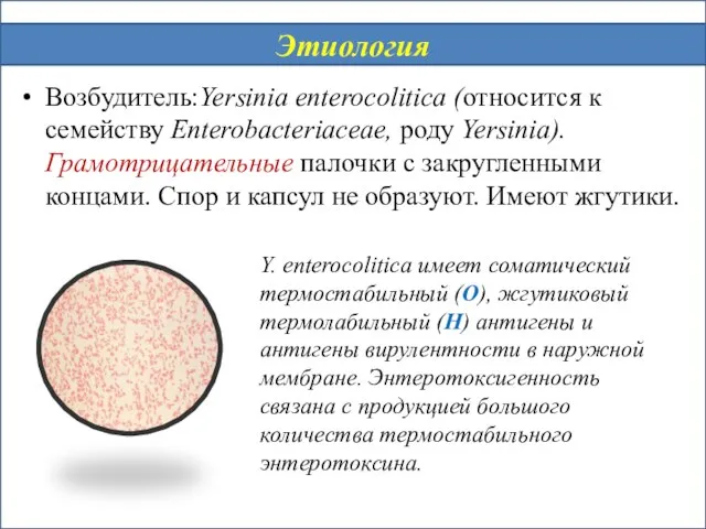 Возбудитель:Yersinia enterocolitica (относится к семейству Enterobacteriaceae, роду Yersinia). Грамотрицательные палочки с