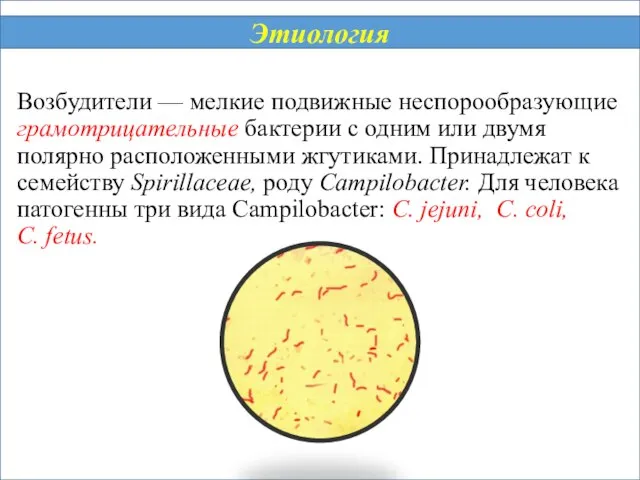 Возбудители — мелкие подвижные неспорообразующие грамотрицательные бактерии с одним или двумя