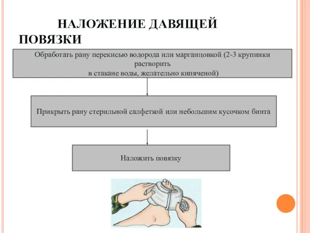 НАЛОЖЕНИЕ ДАВЯЩЕЙ ПОВЯЗКИ Обработать рану перекисью водорода или марганцовкой (2-3 крупинки