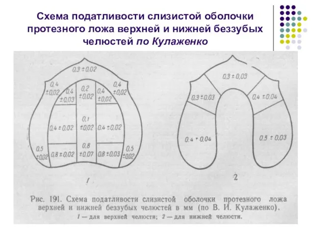 Схема податливости слизистой оболочки протезного ложа верхней и нижней беззубых челюстей по Кулаженко