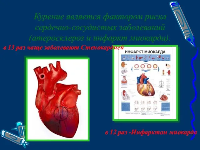 Курение является фактором риска сердечно-сосудистых заболеваний (атеросклероз и инфаркт миокарда). в