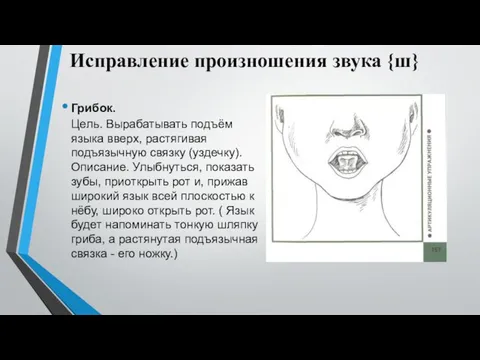 Исправление произношения звука {ш} Грибок. Цель. Вырабатывать подъём языка вверх, растягивая