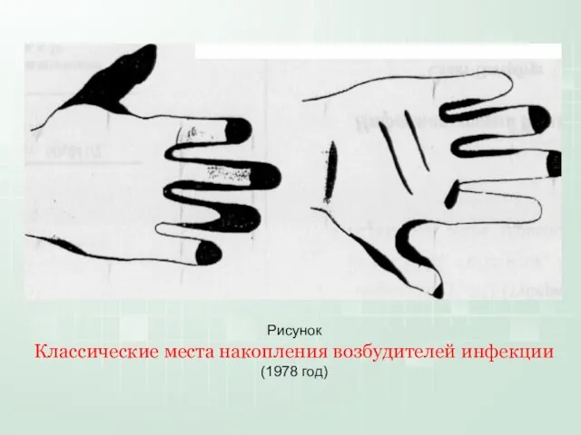 Рисунок Классические места накопления возбудителей инфекции (1978 год)