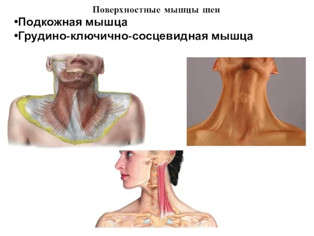 Поверхностные мышцы шеи Подкожная мышца Грудино-ключично-сосцевидная мышца