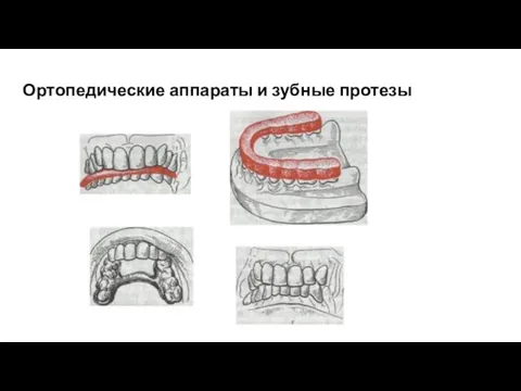 Ортопедические аппараты и зубные протезы