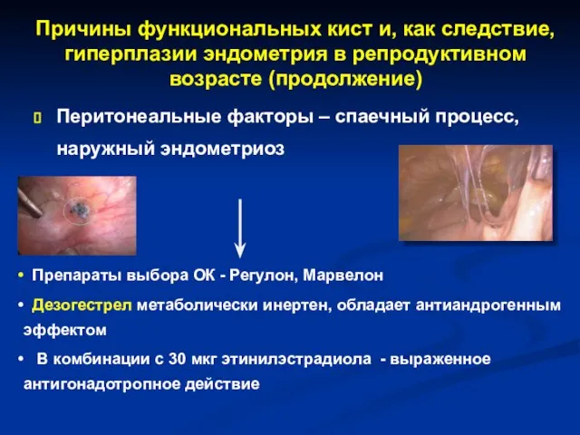 Причины функциональных кист и, как следствие, гиперплазии эндометрия в репродуктивном возрасте