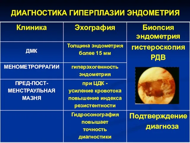 ДИАГНОСТИКА ГИПЕРПЛАЗИИ ЭНДОМЕТРИЯ