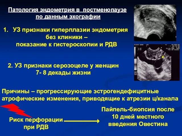 Патология эндометрия в постменопаузе по данным эхографии УЗ признаки гиперплазии эндометрия