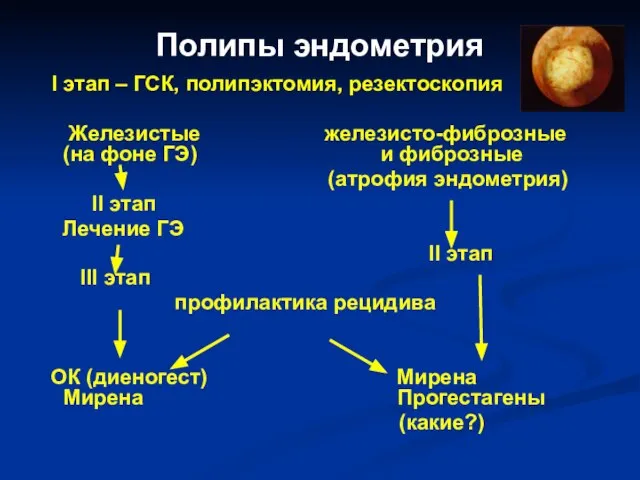 Полипы эндометрия I этап – ГСК, полипэктомия, резектоскопия Железистые железисто-фиброзные (на