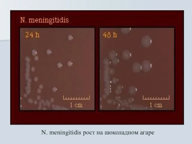 N. meningitidis рост на шоколадном агаре