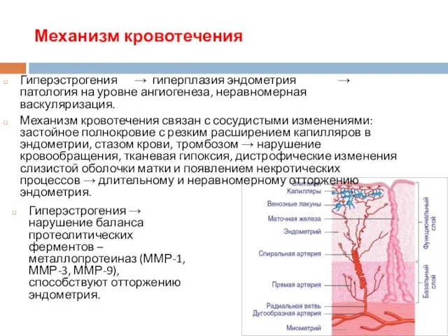 Механизм кровотечения Гиперэстрогения → нарушение баланса протеолитических ферментов – металлопротеиназ (ММР-1,