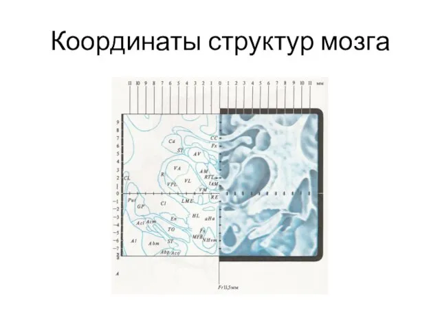 Координаты структур мозга