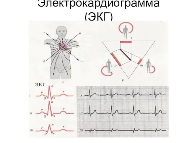 Электрокардиограмма (ЭКГ)