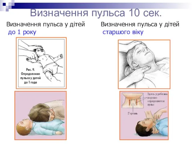 Визначення пульса 10 сек. Визначення пульса у дітей старшого віку Визначення