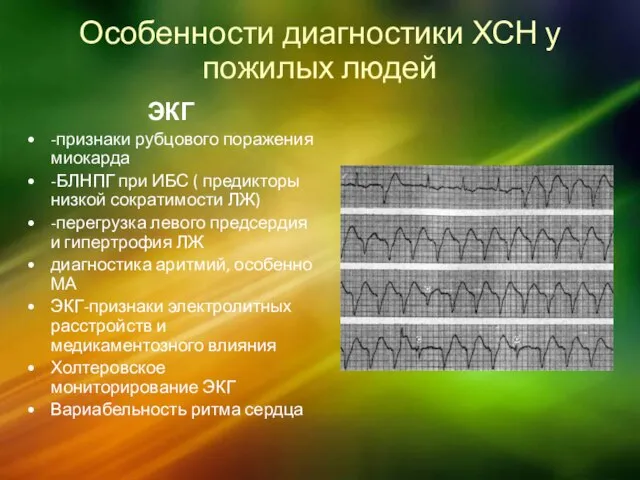 Особенности диагностики ХСН у пожилых людей ЭКГ -признаки рубцового поражения миокарда