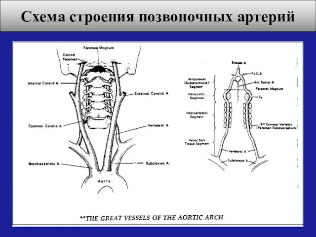 Схема строения позвоночных артерий