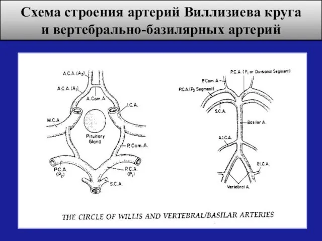 Схема строения артерий Виллизиева круга и вертебрально-базилярных артерий