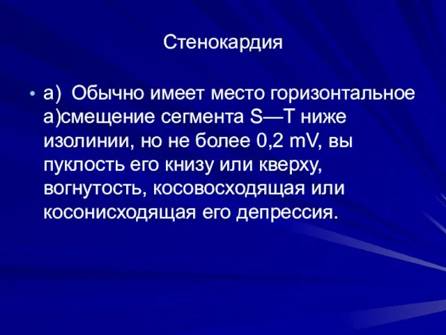 Стенокардия а) Обычно имеет место горизонтальное а)смещение сег­мента S—Т ниже изолинии,